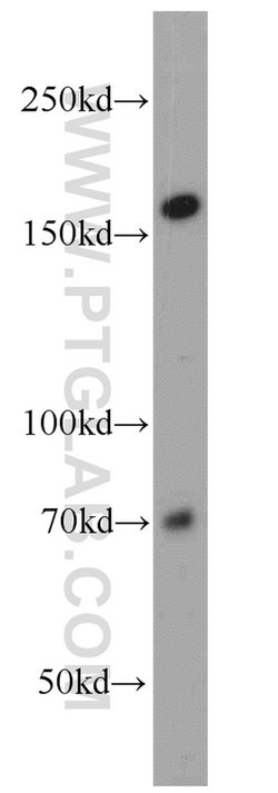 NCAPD3 Rabbit anti-Human, Polyclonal, Proteintech 150 &mu;L; Unconjugated:Antibodies,