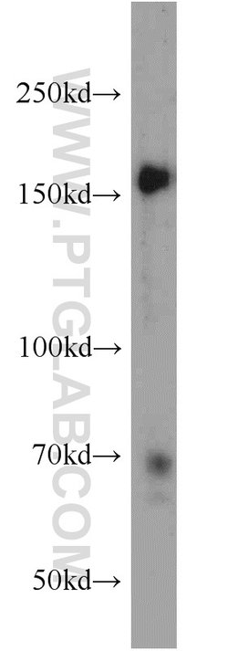 NCAPD3 Rabbit anti-Human, Polyclonal, Proteintech 150 &mu;L; Unconjugated:Antibodies,