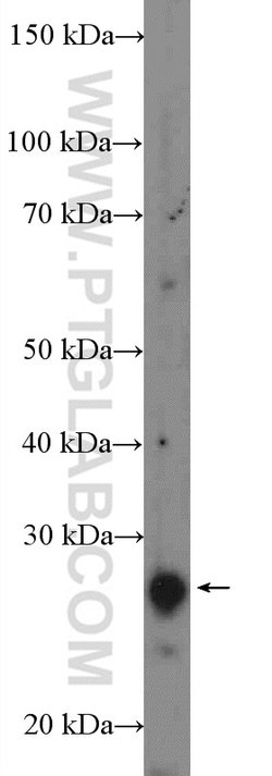 RP9 Rabbit anti-Human, Mouse, Rat, Polyclonal, Proteintech 150 &mu;L; Unconjugated:Antibodies,