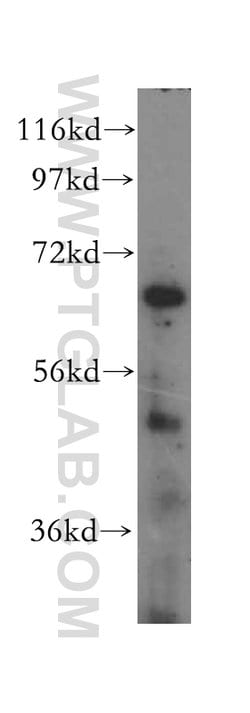 KRT80 Rabbit anti-Human, Mouse, Rat, Polyclonal, Proteintech:Antikörper:Primärantikörper