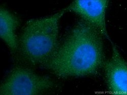 Cytokeratin 1 Rabbit anti-Human, Mouse, Polyclonal, Proteintech:Antibodies:Primary