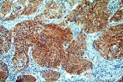 Cytokeratin 1 Rabbit anti-Human, Mouse, Polyclonal, Proteintech 150 &mu;L;