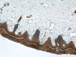 Cytokeratin 1 Rabbit anti-Human, Mouse, Polyclonal, Proteintech:Antibodies:Primary