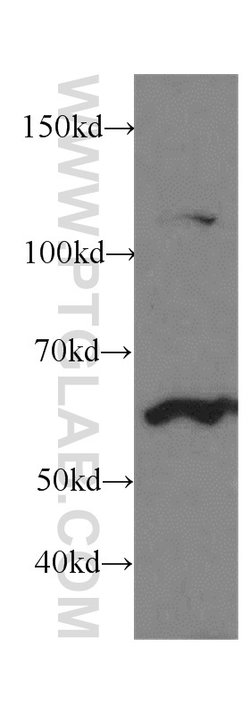 Cytokeratin 1 Rabbit anti-Human, Mouse, Polyclonal, Proteintech 150 &mu;L;