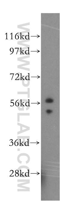 FMO2 Rabbit anti-Human, Mouse, Rat, Polyclonal, Proteintech:Antibodies:Primary