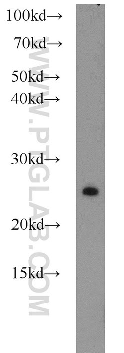 RAB3A Rabbit anti-Human, Mouse, Rat, Polyclonal, Proteintech 150 &mu;L;