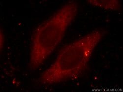 RAB3A Rabbit anti-Human, Mouse, Rat, Polyclonal, Proteintech 150 &mu;L;