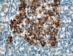 RAB3A Rabbit anti-Human, Mouse, Rat, Polyclonal, Proteintech 150 &mu;L;