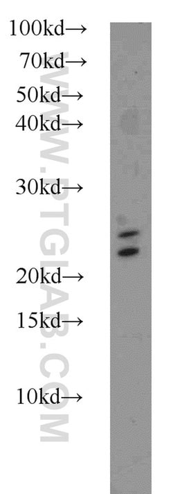 RAB3A Rabbit anti-Human, Mouse, Rat, Polyclonal, Proteintech 150 &mu;L;