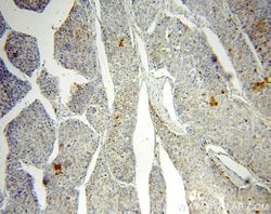 RAB27A Rabbit anti-Human, Polyclonal, Proteintech:Antibodies:Primary Antibodies