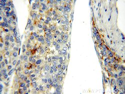 RAB27A Rabbit anti-Human, Polyclonal, Proteintech:Antibodies:Primary Antibodies
