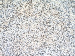 RAB27A Rabbit anti-Human, Polyclonal, Proteintech:Antibodies:Primary Antibodies
