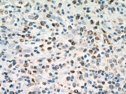 RAB27A Rabbit anti-Human, Polyclonal, Proteintech:Antibodies:Primary Antibodies