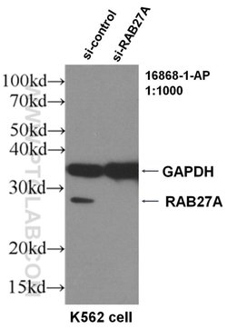 RAB27A Rabbit anti-Human, Polyclonal, Proteintech:Antibodies:Primary Antibodies