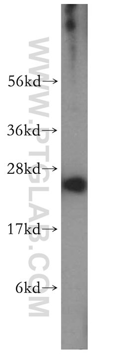 RAB27A Rabbit anti-Human, Polyclonal, Proteintech:Antibodies:Primary Antibodies