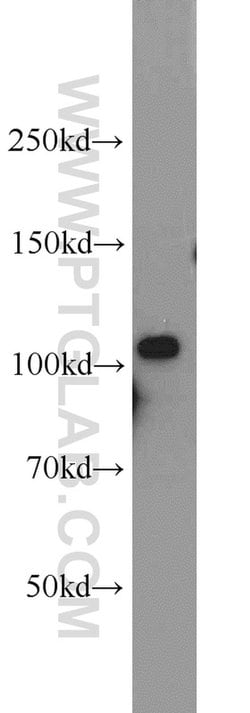 AMOTL1 Rabbit anti-Human, Mouse, Rat, Polyclonal, Proteintech 150 &mu;L;