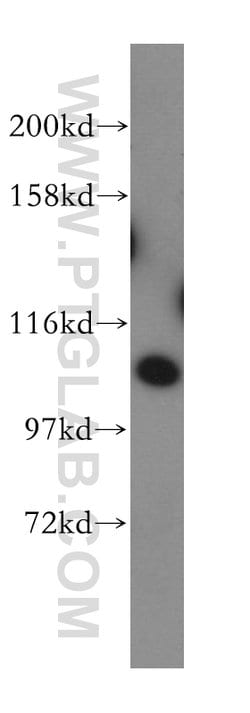 AMOTL1 Rabbit anti-Human, Mouse, Rat, Polyclonal, Proteintech 150 &mu;L;