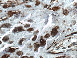 FGF3 Rabbit anti-Human, Polyclonal, Proteintech 150 &mu;L; Unconjugated:Antibodies,