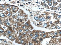 Proteintech FGF3 Rabbit anti-Human, Polyclonal, Proteintech