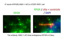 RPGR Rabbit anti-Human, Mouse, Polyclonal, Proteintech 150 &mu;L | Buy Online | Proteintech Group Inc | Fisher Scientific