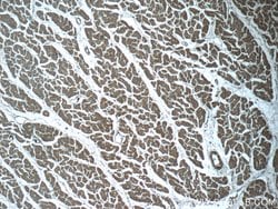 RPGR Rabbit anti-Human, Mouse, Polyclonal, Proteintech 150 &mu;L | Buy Online | Proteintech Group Inc | Fisher Scientific