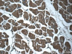 RPGR Rabbit anti-Human, Mouse, Polyclonal, Proteintech 150 &mu;L | Buy Online | Proteintech Group Inc | Fisher Scientific
