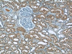 RPGR Rabbit anti-Human, Mouse, Polyclonal, Proteintech 150 &mu;L | Buy Online | Proteintech Group Inc | Fisher Scientific