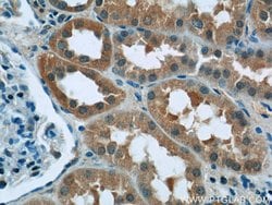 RPGR Rabbit anti-Human, Mouse, Polyclonal, Proteintech 150 &mu;L | Buy Online | Proteintech Group Inc | Fisher Scientific