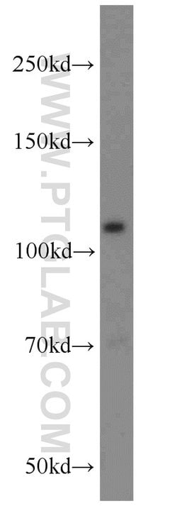 RPGR Rabbit anti-Human, Mouse, Polyclonal, Proteintech 150 &mu;L | Buy Online | Proteintech Group Inc | Fisher Scientific