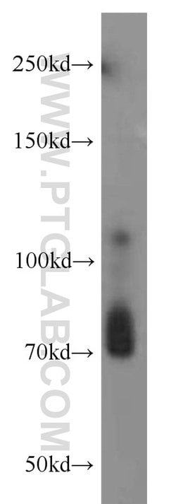 RPGR Rabbit anti-Human, Mouse, Polyclonal, Proteintech 150 &mu;L | Buy Online | Proteintech Group Inc | Fisher Scientific