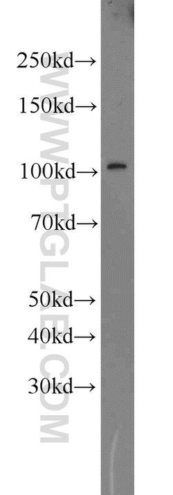 RPGR Rabbit anti-Human, Mouse, Polyclonal, Proteintech 150 &mu;L | Buy Online | Proteintech Group Inc | Fisher Scientific