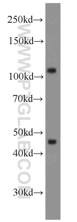 RPGR Rabbit anti-Human, Mouse, Polyclonal, Proteintech 150 &mu;L | Buy Online | Proteintech Group Inc | Fisher Scientific