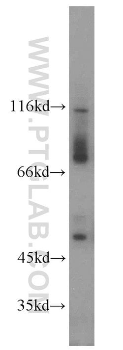RPGR Rabbit anti-Human, Mouse, Polyclonal, Proteintech 150 &mu;L | Buy Online | Proteintech Group Inc | Fisher Scientific