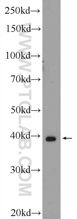 CRYZL1 Rabbit anti-Human, Mouse, Non-human primate, Rat, Polyclonal, Proteintech
