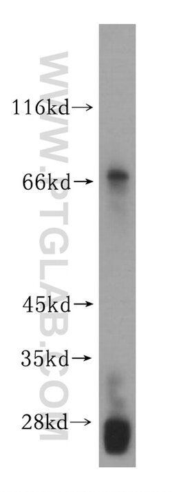 GALNTL2 Rabbit anti-Human, Polyclonal, Proteintech 150 &mu;L; Unconjugated:Antibodies,