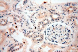 UNC13D/Munc13-4 Rabbit anti-Human, Polyclonal, Proteintech:Anticorps:Anticorps