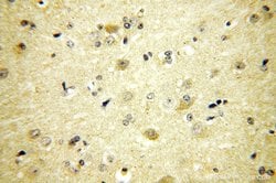 PIGT Rabbit anti-Human, Polyclonal, Proteintech:Antibodies:Primary Antibodies