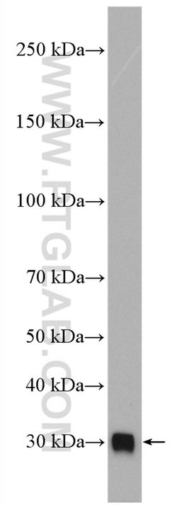 C1qB Rabbit anti-Human, Polyclonal, Proteintech:Antibodies:Primary Antibodies