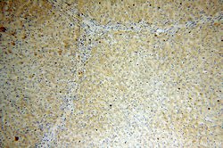vitamin D binding protein Rabbit anti-Human, Mouse, Rat, Polyclonal, Proteintech