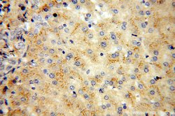 vitamin D binding protein Rabbit anti-Human, Mouse, Rat, Polyclonal, Proteintech
