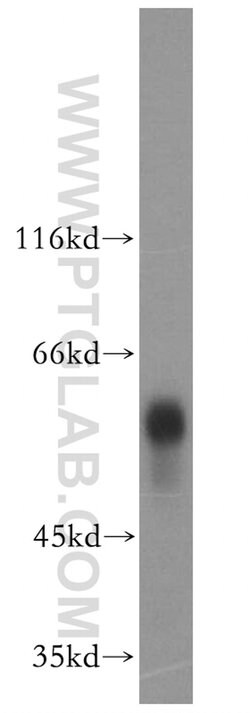 vitamin D binding protein Rabbit anti-Human, Mouse, Rat, Polyclonal, Proteintech