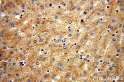 vitamin D binding protein Rabbit anti-Human, Mouse, Rat, Polyclonal, Proteintech