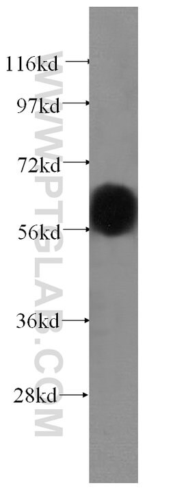 vitamin D binding protein Rabbit anti-Human, Mouse, Rat, Polyclonal, Proteintech