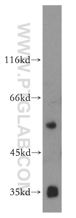 vitamin D binding protein Rabbit anti-Human, Mouse, Rat, Polyclonal, Proteintech