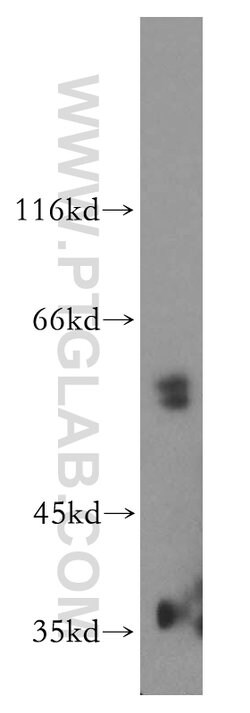 vitamin D binding protein Rabbit anti-Human, Mouse, Rat, Polyclonal, Proteintech