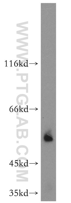 vitamin D binding protein Rabbit anti-Human, Mouse, Rat, Polyclonal, Proteintech