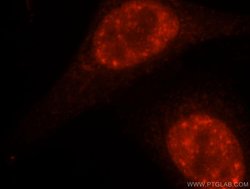 DDX46 Rabbit anti-Human, Mouse, Rat, Polyclonal, Proteintech 150 &mu;L;