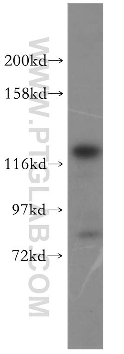 DDX46 Rabbit anti-Human, Mouse, Rat, Polyclonal, Proteintech 150 &mu;L;