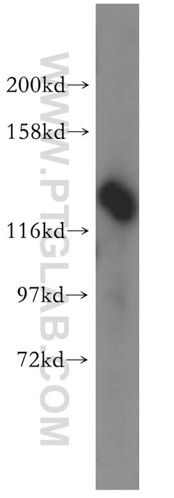 DDX46 Rabbit anti-Human, Mouse, Rat, Polyclonal, Proteintech 150 &mu;L;
