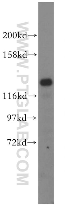 DDX46 Rabbit anti-Human, Mouse, Rat, Polyclonal, Proteintech 150 &mu;L;
